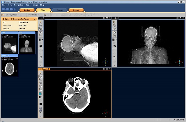 DICOM Viewer for Free Download