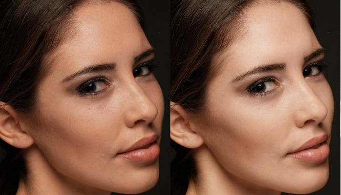 download the new version for mac Retouch4me Heal 1.018 / Dodge / Skin Tone